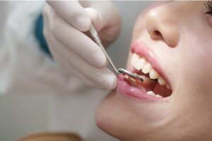 dental implants Brisbane