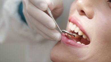 dental implants Brisbane